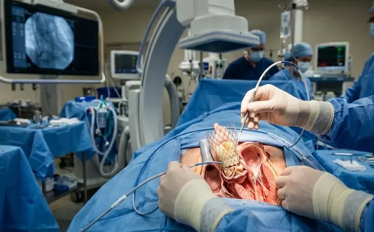 Valve-in-Valve TAVR for Failed Bioprosthetic Valves