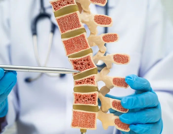 Osteoporosis