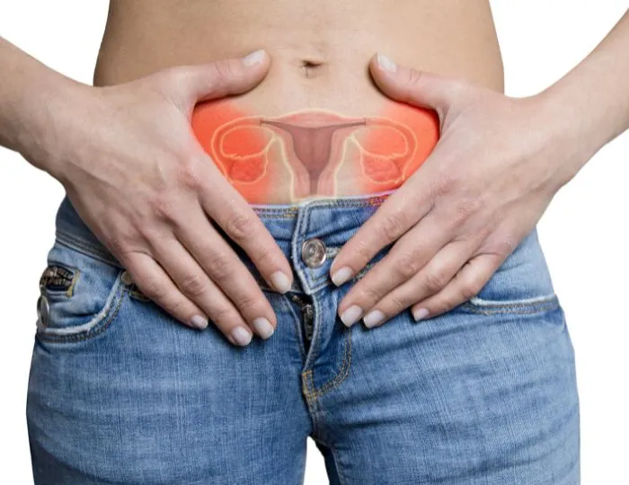 Ovarian Cysts