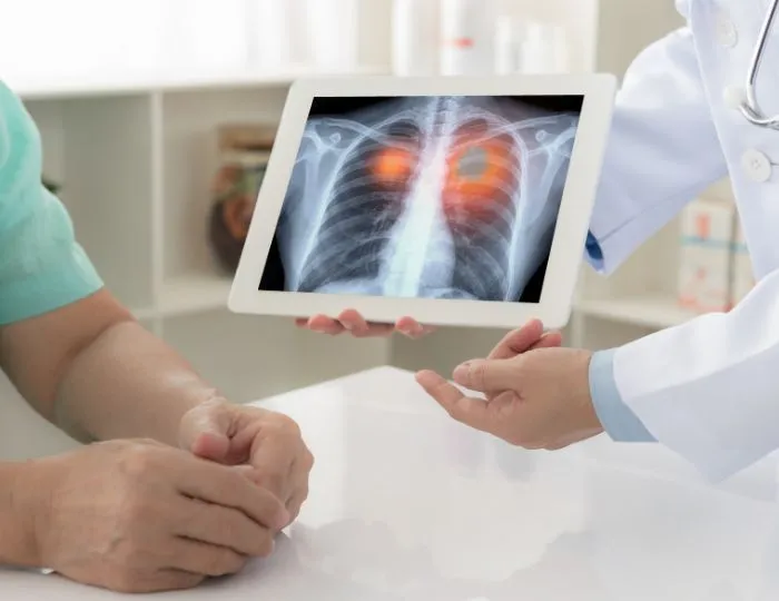 Interstitial Lung Disease (ILD)