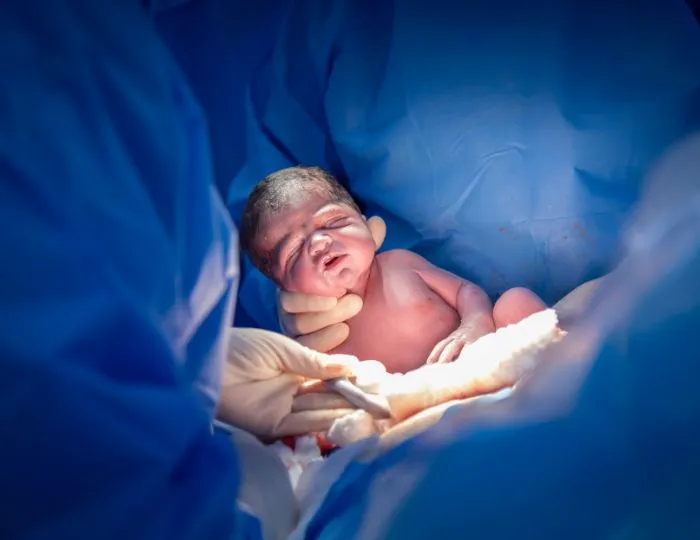 Low Birth Weight